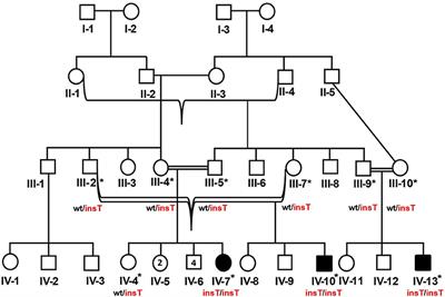 A Novel Homozygous Frameshift Variant in DYM Causing Dyggve-Melchior-Clausen Syndrome in Pakistani Patients